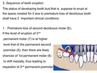 5. Sequence of teeth eruption:
The status of developing tooth bud that is suppose to erupt at
the space created for it due to premature loss of deciduous tooth
shall have 2 important clinical conditions.
1. Premature loss of second deciduous molar (E).
If the level of eruption of 2nd
permanent molar (7) is at higher
level that of the permanent second
premolar (5), then there are likely
chances of 1st permanent molar (6)
to drift mesially, thus leading to
impaction of 2nd permanent premolar.
 