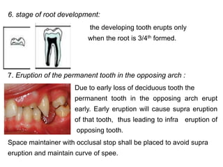 6. stage of root development:
the developing tooth erupts only
when the root is 3/4th formed.
7. Eruption of the permanent tooth in the opposing arch :
Due to early loss of deciduous tooth the
permanent tooth in the opposing arch erupt
early. Early eruption will cause supra eruption
of that tooth, thus leading to infra eruption of
an opposing tooth.
Space maintainer with occlusal stop shall be placed to avoid supra
eruption and maintain curve of spee.
 