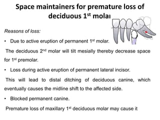 Space maintainers for premature loss of
deciduous 1st molar
Reasons of loss:
• Due to active eruption of permanent 1st molar.
The deciduous 2nd molar will tilt mesially thereby decrease space
for 1st premolar.
• Loss during active eruption of permanent lateral incisor.
This will lead to distal ditching of deciduous canine, which
eventually causes the midline shift to the affected side.
• Blocked permanent canine.
Premature loss of maxillary 1st deciduous molar may cause it
 