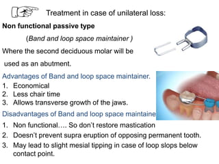 Treatment in case of unilateral loss:
Non functional passive type
(Band and loop space maintainer )
Where the second deciduous molar will be
used as an abutment.
Advantages of Band and loop space maintainer.
1. Economical
2. Less chair time
3. Allows transverse growth of the jaws.
Disadvantages of Band and loop space maintainer.
1. Non functional…. So don’t restore mastication
2. Doesn’t prevent supra eruption of opposing permanent tooth.
3. May lead to slight mesial tipping in case of loop slops below
contact point.
 