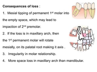 Consequences of loss :
1. Mesial tipping of permanent 1st molar into
the empty space, which may lead to
impaction of 2nd premolar.
2. If the loss is in maxillary arch, then
the 1st permanent molar will rotate
mesially, on its palatal root making it axis .
3. Irregularity in molar relationship.
4. More space loss in maxillary arch than mandibular.
 
