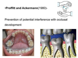•Proffitt and Ackermann(1980)-
Prevention of potential interference with occlusal
development
 