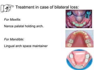 Treatment in case of bilateral loss:
For Maxilla:
Nance palatal holding arch.
For Mandible:
Lingual arch space maintainer
 