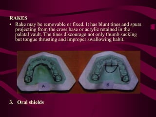 Paltal Rake PREVENTIVE ORTHODONTICS(Dr.ABDUL SHAMAL) | PPT