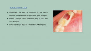 Bondable Loop PREVENTIVE ORTHODONTICS WITH SPACE MANAGMENT.pptx