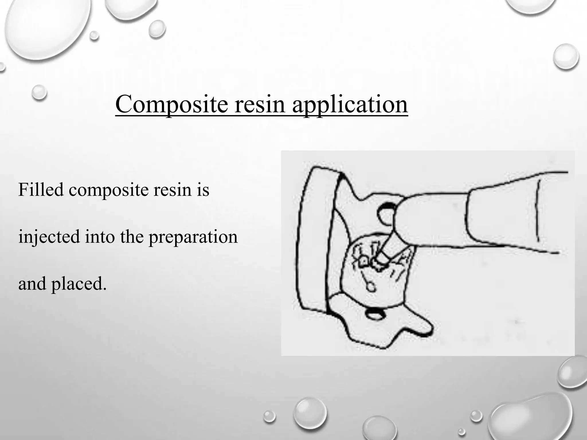Preventive resin restoration PPT