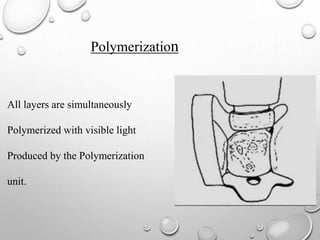 Preventive resin restoration | PPTX