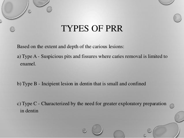 Prr Tooth What Are Some Examples Of Prr? – SPPI