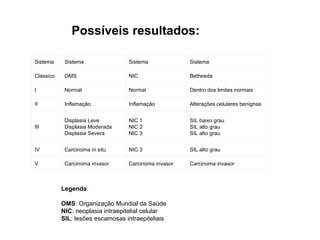 Possíveis resultados:   Legenda : OMS : Organização Mundial da Saúde NIC : neoplasia intraepitelial celular SIL : lesões escamosas intraepiteliais  Carcinoma invasor Carcinoma invasor Carcinoma invasor V SIL alto grau NIC 3 Carcinoma in situ IV SIL baixo grau SIL alto grau SIL alto grau NIC 1 NIC 2 NIC 3 Displasia Leve Displasia Moderada Displasia Severa III Alterações celulares benignas Inflamação Inflamação II Dentro dos limites normais Normal Normal I Bethesda NIC OMS Clássico Sistema Sistema Sistema Sistema 