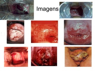 Imagens 