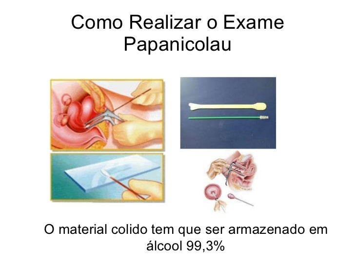 Como e feito o exame de prostata