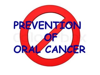 PREVENTION
OF
ORAL CANCER
 