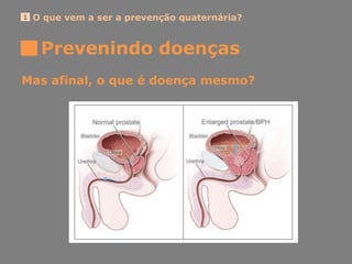 O que vem a ser a prevenção quaternária?1
Mas afinal, o que é doença mesmo?
Prevenindo doenças
 