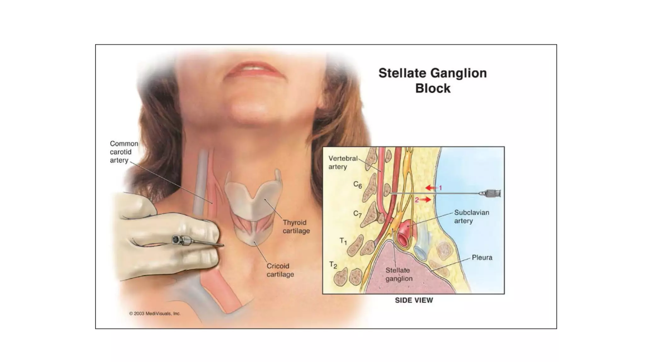 Prevertebral muscles