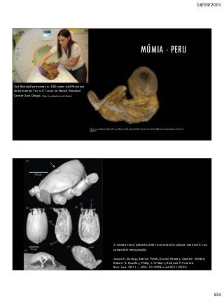 18/09/2015
104
MÚMIA - PERU
http://www.ancient-origins.net/news-history-archaeology/scientists-set-unravel-secrets-oldest-peruvian-mummies-ever-found-
003137
Tori Randall prepares a 550-year-old Peruvian
child mummy for a CT scan at Naval Medical
Center San Diego. (https://en.wikipedia.org/wiki/Mummy)
A minute fossil phoretic mite recovered by phase-contrast X-ray
computed tomography
Jason A. Dunlop, Stefan Wirth, David Penney, Andrew McNeil,
Robert S. Bradley, Philip J. Withers, Richard F. Preziosi
Biol. Lett. 2011 -; DOI: 10.1098/rsbl.2011.0923
X-ray computed tomography of the tiny, phoretic deutonymph of
a fossil mite (Acariformes: Astigmata: ?Histiostomatidae) from
 