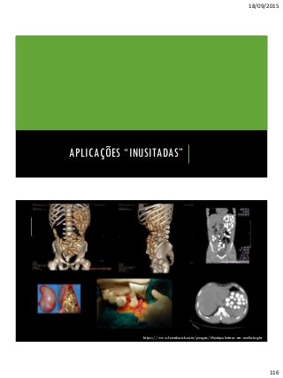 18/09/2015
116
APLICAÇÕES “INUSITADAS”
https://www.facebook.com/pages/Manipulateur-en-radiologie
 