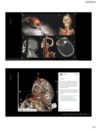 18/09/2015
117
https://fbcdn-sphotos-h-a.akamaihd.net/hphotos-ak-xft1/v/t1.0-
9/1907498_817453018350681_8026481951672846179_n.jpg?oh=f3862ef39b601048a27a43eb5d792fd4&oe=56280B77&__gda__=1445810513_8bc4145750592b56bc62223f3577b4e3
https://instagram.com/p/6Qn_zuEw1V/
 