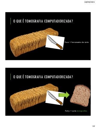 18/09/2015
18
O QUE É TOMOGRAFIA COMPUTADORIZADA?
Faca = ferramenta de corte
O QUE É TOMOGRAFIA COMPUTADORIZADA?
http://ligiadantas.com.br/wp-
content/uploads/2013/10/Integralde-forma-light_fatia-de-
.25g_54cal.jpg
Fatia = corte tomográfico
 