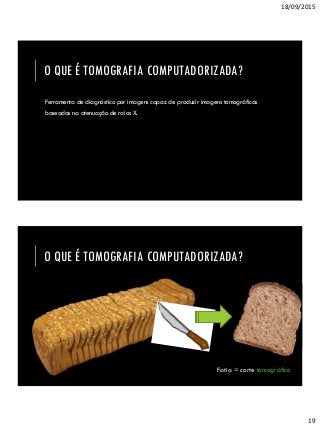 18/09/2015
19
O QUE É TOMOGRAFIA COMPUTADORIZADA?
http://ligiadantas.com.br/wp-
content/uploads/2013/10/Integralde-forma-light_fatia-de-
.25g_54cal.jpg
Ferramenta de diagnóstico por imagens capaz de produzir imagens tomográficas
baseadas na atenuação de raios X.
O QUE É TOMOGRAFIA COMPUTADORIZADA?
http://ligiadantas.com.br/wp-
content/uploads/2013/10/Integralde-forma-light_fatia-de-
.25g_54cal.jpg
Fatia = corte tomográfico
 