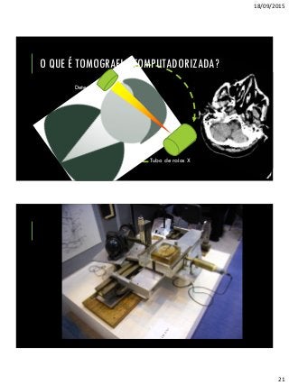 18/09/2015
21
O QUE É TOMOGRAFIA COMPUTADORIZADA?
http://ligiadantas.com.br/wp-
content/uploads/2013/10/Integralde-forma-light_fatia-de-
.25g_54cal.jpg
Tubo de raios X
Detector
Tubo de raios X
 