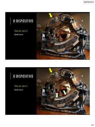 18/09/2015
27
O DISPOSITIVO
Tubo de raios X
Detectores
O DISPOSITIVO
Tubo de raios X
Detectores
 
