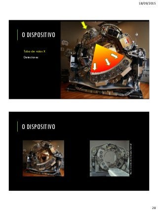 18/09/2015
28
O DISPOSITIVO
Tubo de raios X
Detectores
http://www.emsts.com.br/imagens/light4.gif
O DISPOSITIVO
 