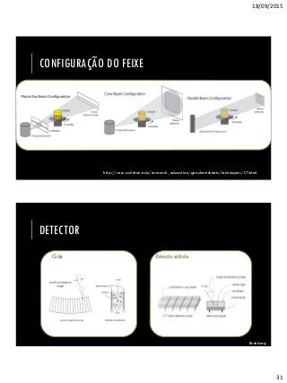 18/09/2015
31
CONFIGURAÇÃO DO FEIXE
http://serc.carleton.edu/research_education/geochemsheets/techniques/CT.html
DETECTOR
Gás Estado sólido
Bushberg
 