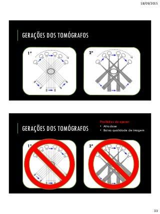 18/09/2015
33
GERAÇÕES DOS TOMÓGRAFOS
2ª1ª
GERAÇÕES DOS TOMÓGRAFOS
2ª1ª
Proibidos de operar
• Alta dose
• Baixa qualidade de imagem
 