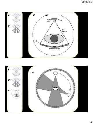 18/09/2015
34
3ª
2ª
1ª
4ª
3ª
2ª
1ª
 