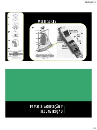 18/09/2015
36
MULTI SLICES
6ª
4ª
3ª
2ª
1ª
7ª
PASSO 3: AQUISIÇÃO E
RECONSTRUÇÃO
 