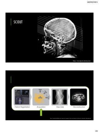 18/09/2015
39
SCOUT
http://anatpat.unicamp.br/
http://medical.toshiba.com/resources/images/ct/aq-one-family/aq-one-dose-reduction-diagram.jpg
 