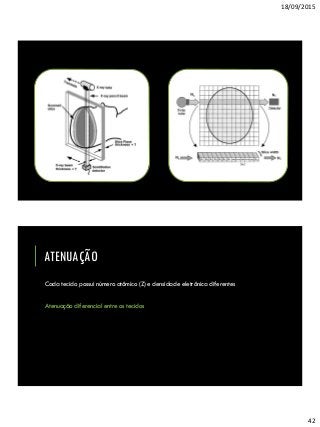 18/09/2015
42
ATENUAÇÃO
Cada tecido possui número atômico (Z) e densidade eletrônica diferentes
Atenuação diferencial entre os tecidos
 