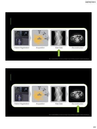 18/09/2015
43
http://medical.toshiba.com/resources/images/ct/aq-one-family/aq-one-dose-reduction-diagram.jpg
http://medical.toshiba.com/resources/images/ct/aq-one-family/aq-one-dose-reduction-diagram.jpg
 