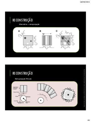 18/09/2015
46
Alternativa – retroprojeção
RECONSTRUÇÃO
RECONSTRUÇÃO
Retroprojeção filtrada
Adaptadodehttp://en.wikibooks.org/wiki/Basic_Physics_of_Nuclear_Medicine/X-Ray_CT_in_Nuclear_Medicine
 