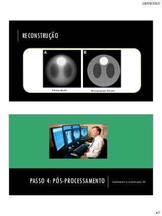 18/09/2015
47
RECONSTRUÇÃO
Retroprojeção Retroprojeção filtrada
Janelamento e reconstrução 3DPASSO 4: PÓS-PROCESSAMENTO
 