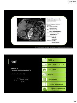 18/09/2015
48
http://www.medarcade.com/blog/tissue-densities-on-ct-scan-in-hounsfield-units-or-ct-number
Número CT
 Informação quantitativa e qualitativa
 Unidades Hounsfield (HU)
“COR”
𝐶𝑇 =
1000 𝜇 𝑣𝑜𝑥𝑒𝑙 − 𝜇 𝐻2 𝑂
𝜇 𝐻2 𝑂
-1000: ar-1000: ar
-300 a -100: partes moles-300 a -100: partes moles
-200: pulmão-200: pulmão
0: água0: água
+50: músculos+50: músculos
+1000: osso compacto+1000: osso compacto
> + 3000: próteses, áreas
com meio de contraste
> + 3000: próteses, áreas
com meio de contraste
 