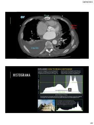 18/09/2015
49
Líquido
Osso
Partes
moles
HISTOGRAMA
 