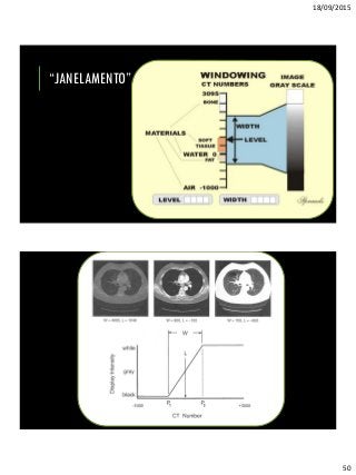 18/09/2015
50
“JANELAMENTO”
 