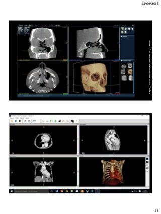 18/09/2015
53
https://www.kentuckianaent.com/services/ct-scans
 