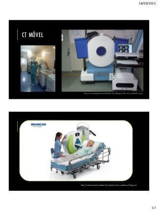 18/09/2015
57
CT MÓVEL
http://www.neurologyindia.com/articles/2011/59/5/images/ni_2011_59_5_739_86551_f1.jpg
http://braincon.com/medical-2/products/verity-mobile-ct/?lang=en
 