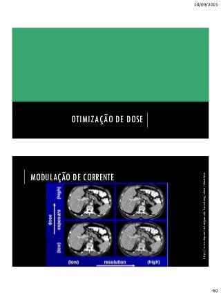 18/09/2015
60
OTIMIZAÇÃO DE DOSE
MODULAÇÃO DE CORRENTE
http://www.imp.uni-erlangen.de/forschung/dose/dose.htm
 