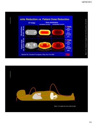 18/09/2015
61
http://www.imp.uni-erlangen.de/forschung/dose/dose.htm
http://xrayphysics.com/ctdose.html
 