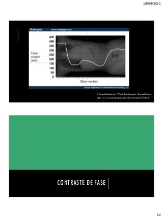 18/09/2015
62
CT and Radiation: What Radiologists Should Know
http://www.medscape.com/viewarticle/572551
CONTRASTE DE FASE
 