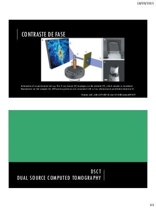 18/09/2015
63
CONTRASTE DE FASE
Schematic of experimental set-up. The X-ray beam (X) impinges on the pinhole (P), which creates a localized
illumination on the sample (S). Diffraction patterns are recorded with a two-dimensional pixellated detector D.
Nature 467, 436–439 (2010) doi:10.1038/nature09419
DSCT
DUAL SOURCE COMPUTED TOMOGRAPHY
 