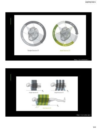 18/09/2015
64
http://www.dsct.com/
http://www.dsct.com/
 
