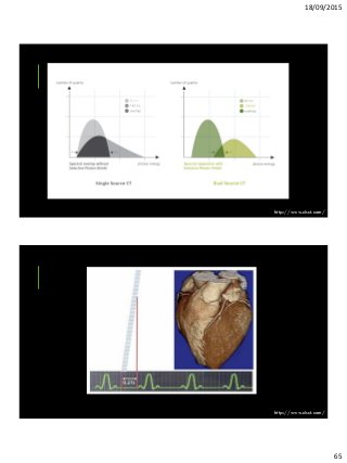 18/09/2015
65
http://www.healthcare.siemens.com/siemens_hwem-
hwem_ssxa_websites-context-
root/wcm/idc/groups/public/@global/@imaging/@ct/docum
ents/image/mdaw/njax/~edisp/ct-somatom-definition-flash-
technical-dual_energy_with_selective_photon_shield-
00379533/~renditions/ct-somatom-definition-flash-technical-
dual_energy_with_selective_photon_shield-00379533~10.jpg
http://www.dsct.com/
http://www.dsct.com/
 