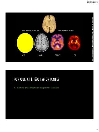 18/09/2015
7
http://www.unige.ch/cyberdocuments/theses2000/ZaidiH/these_body.html
CT MRI SPECT PET
IMAGENS ANATÔMICAS IMAGENS FUNCIONAIS
POR QUE CT É TÃO IMPORTANTE?
1 – é um dos procedimentos de imagem mais realizados
 
