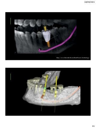 18/09/2015
81
http://www.thecenterfororalhealth.com/technology/
 