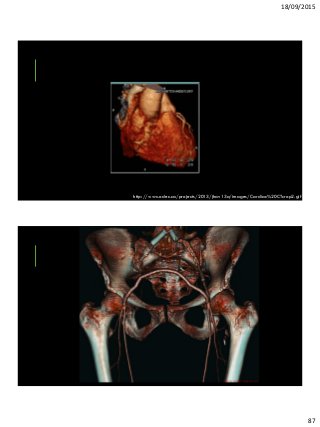 18/09/2015
87
http://www.odec.ca/projects/2013/jhav13a/images/Cardiac%20CTcrop2.gif
 