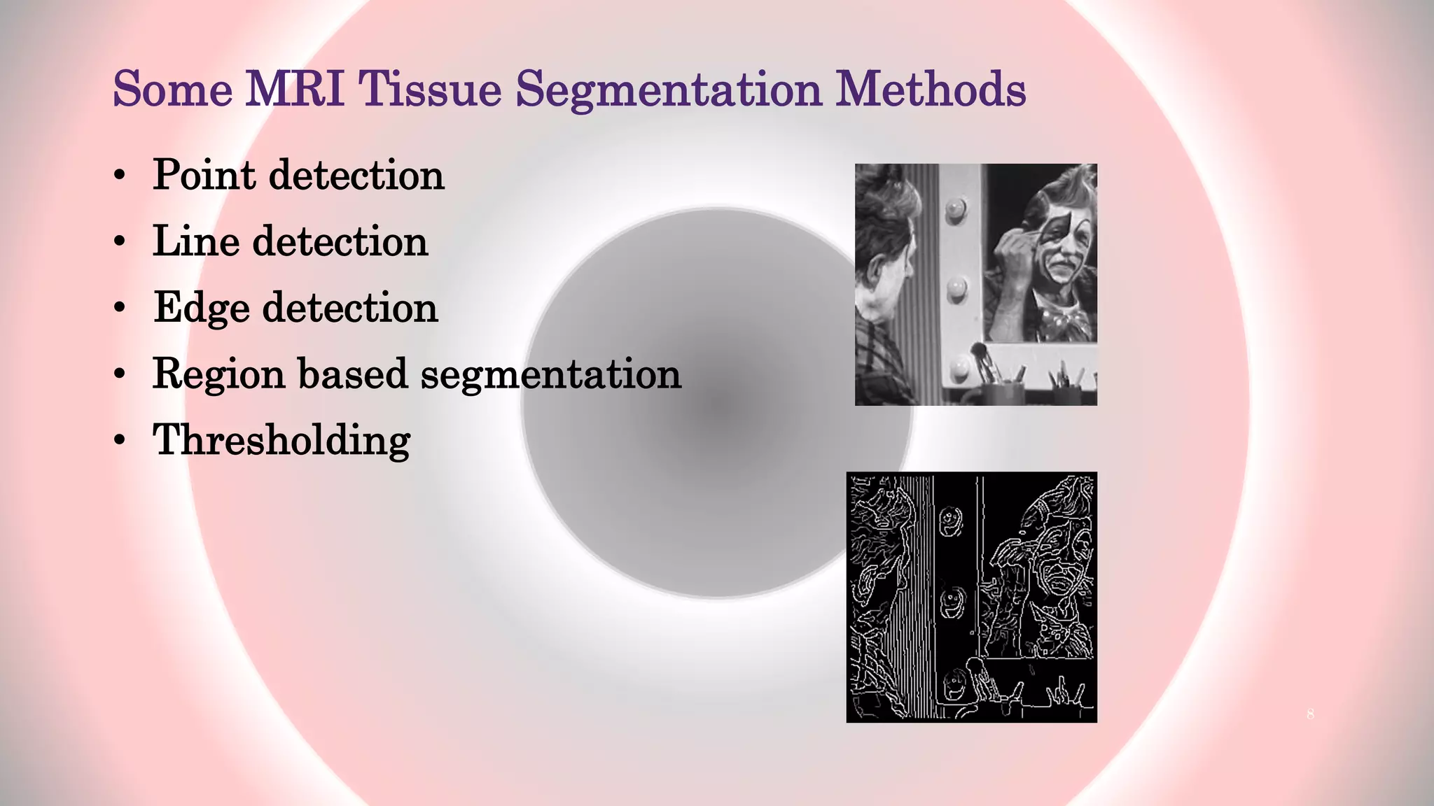 Some MRI Tissue Segmentation Methods
• Point detection
• Line detection
• Edge detection
• Region based segmentation
• Thresholding
8
 